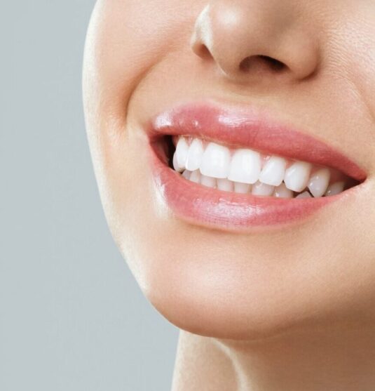 dental bonding in Towson MD at Smithberger DDS